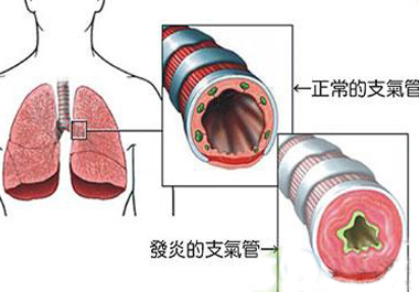 支氣管炎補硒