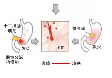 補硒胃炎