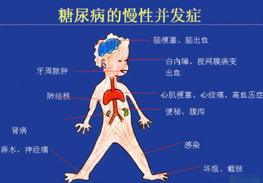 你還在害怕高血糖嗎？科學(xué)補(bǔ)硒不“恐糖”